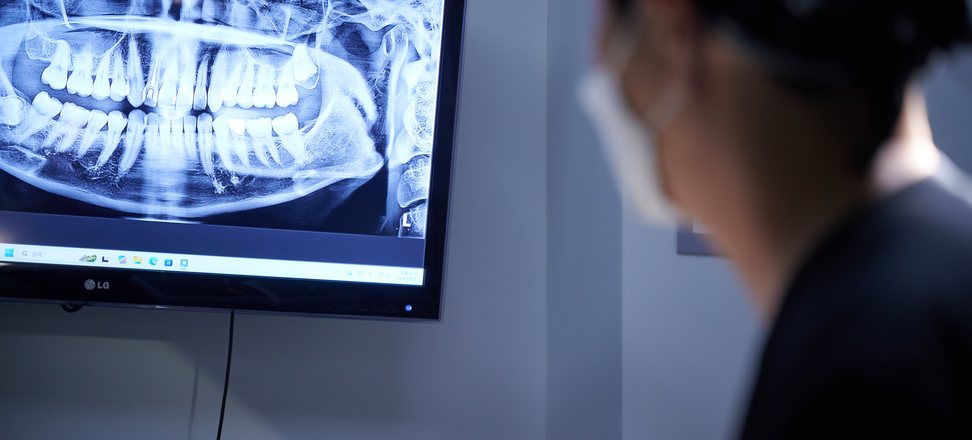 파노라마 영상을 화면에 띄워 잔존골 위치를 확인하는 임태윤 대표원장