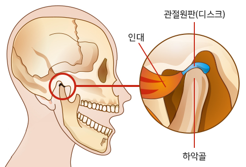 정상적인 턱관절 도해